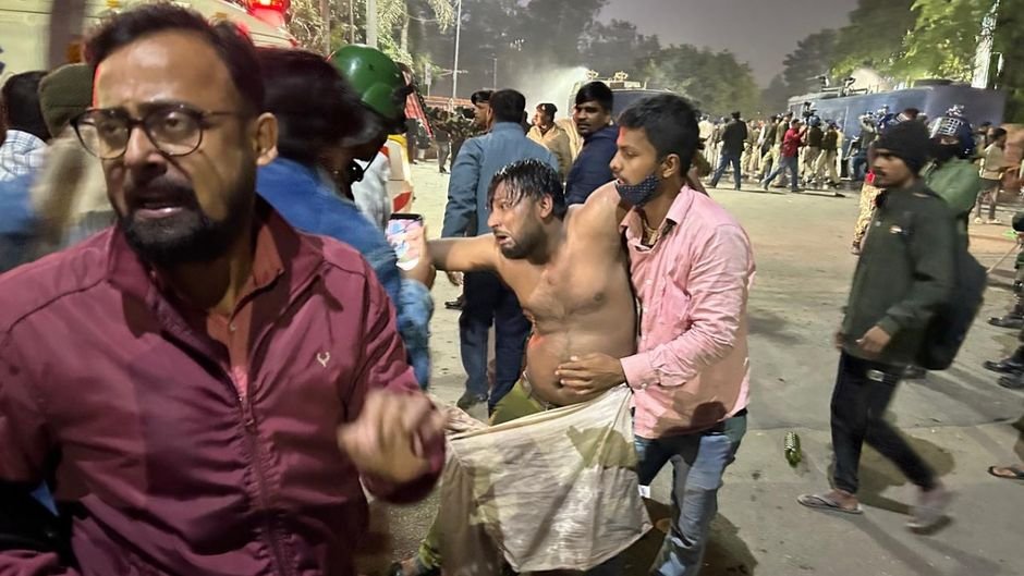 लाठीचार्ज में घायल BPSC की  अभ्यर्थ।